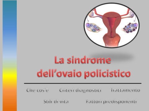 ovaio policistico