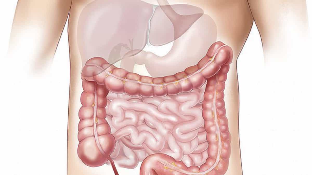 sindrome dell'intestino gocciolante